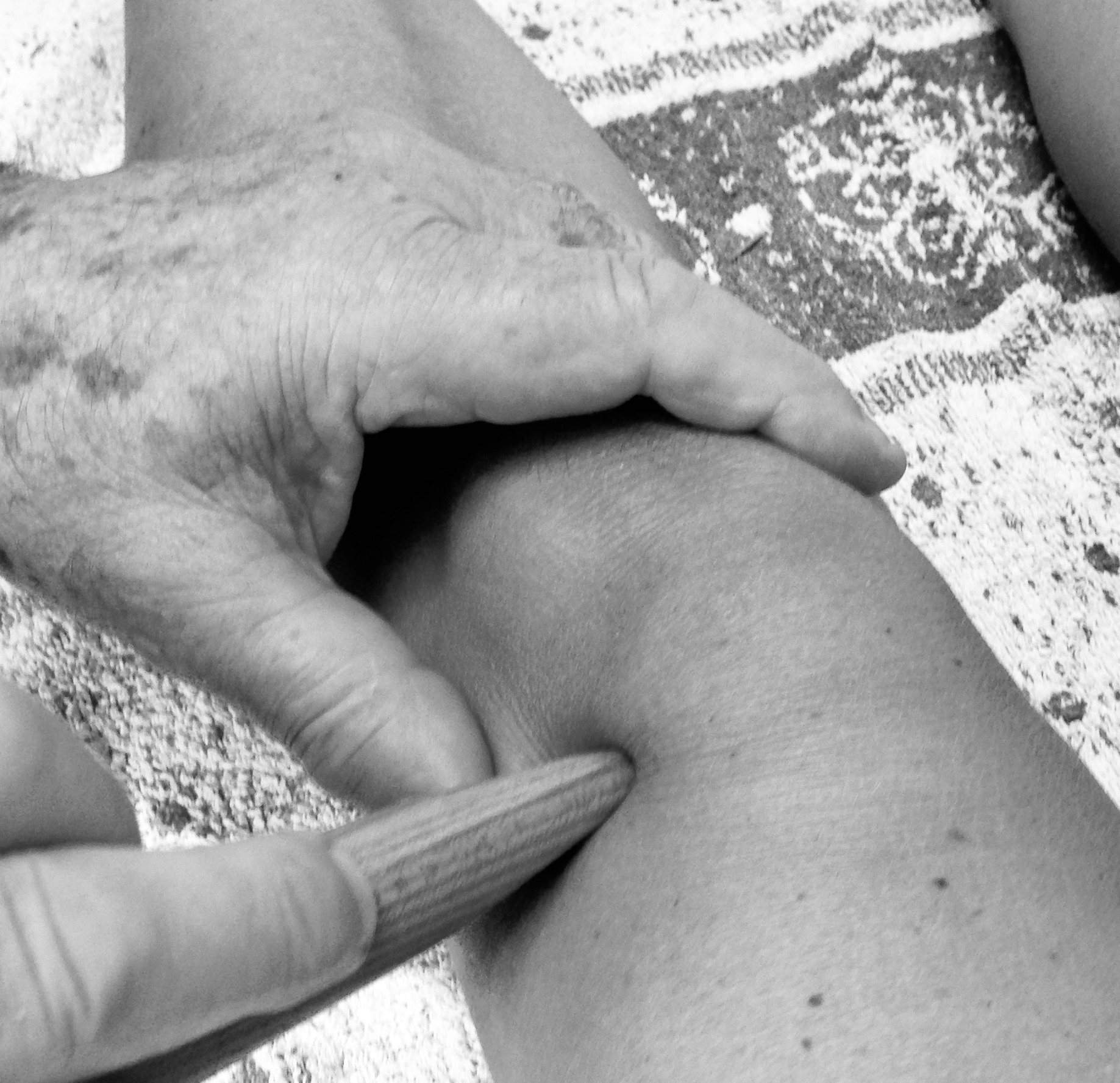 Damsted-teknikken, knæ